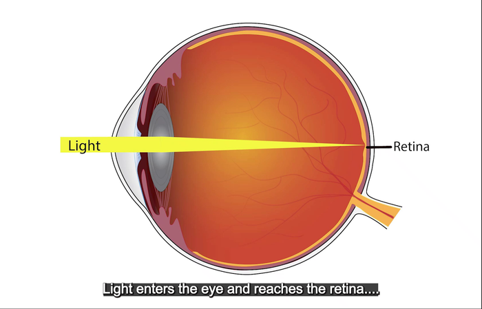 refractive errors of the eye